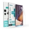 [3 Pcs] Samsung Galaxy Note 20 Ultra Hydrogel Full Cover Screen Protector